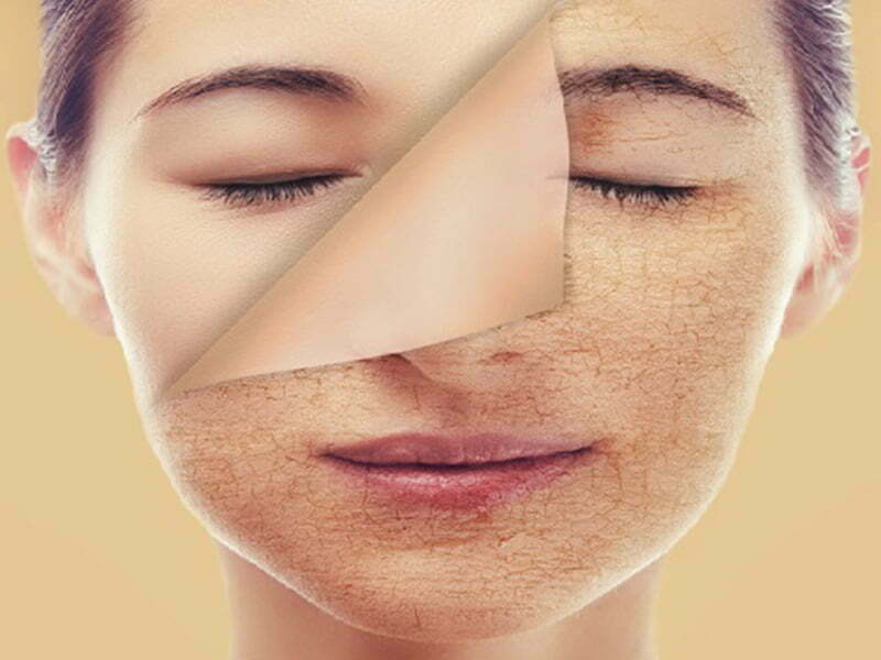 Collagen và mô liên kết bên dưới lớp ngoài cùng của da có có thể bị tổn hại nếu phải tiếp xúc với tia UV