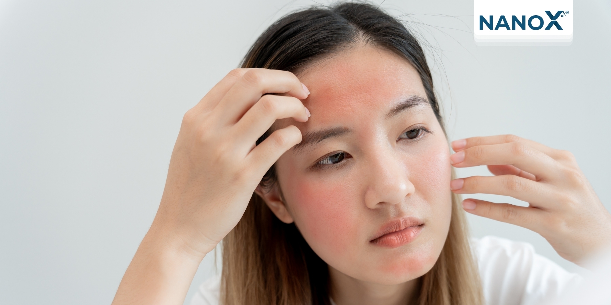Da bị cháy nắng là do tiếp cận quá nhiều tia UV