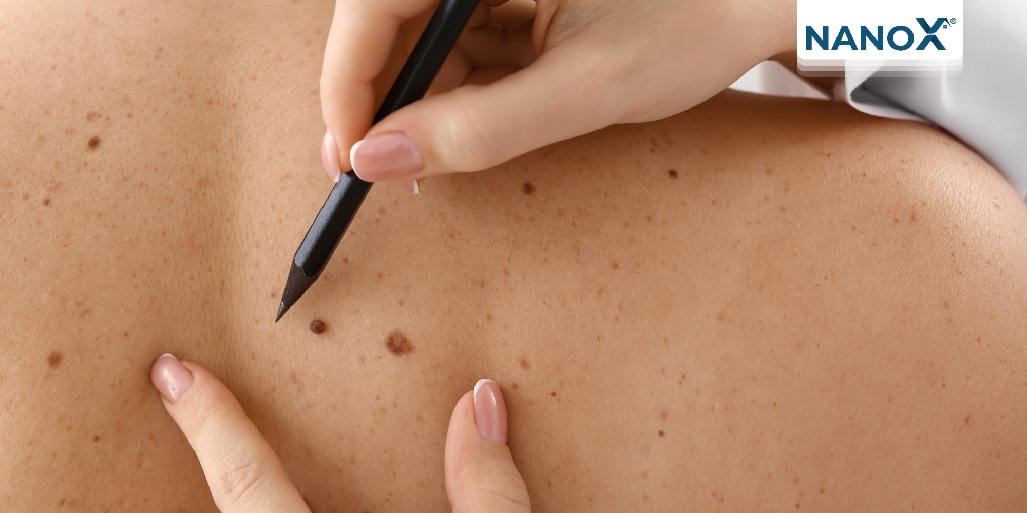Collagen và mô liên kết bên dưới lớp ngoài cùng của da có có thể bị tổn hại nếu phải tiếp xúc với tia UV