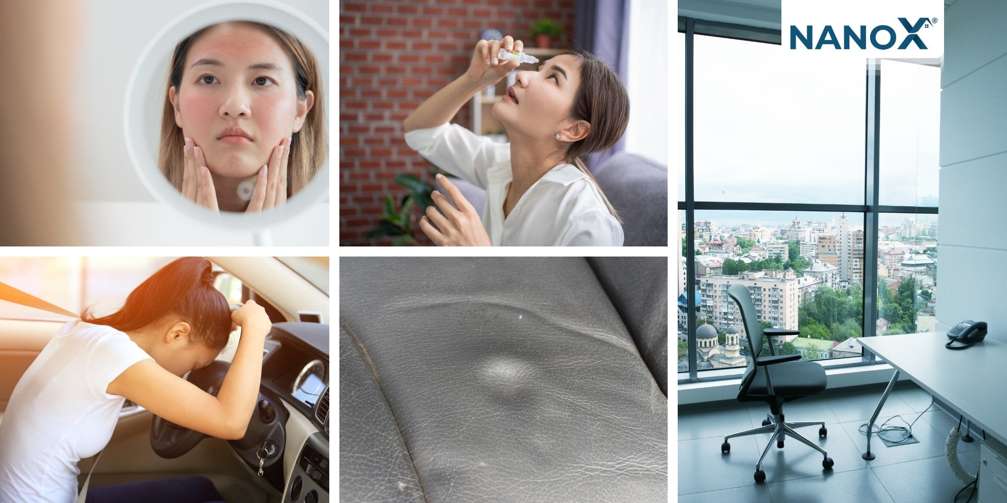 Tia UV được ví như “sát thủ thầm lặng”